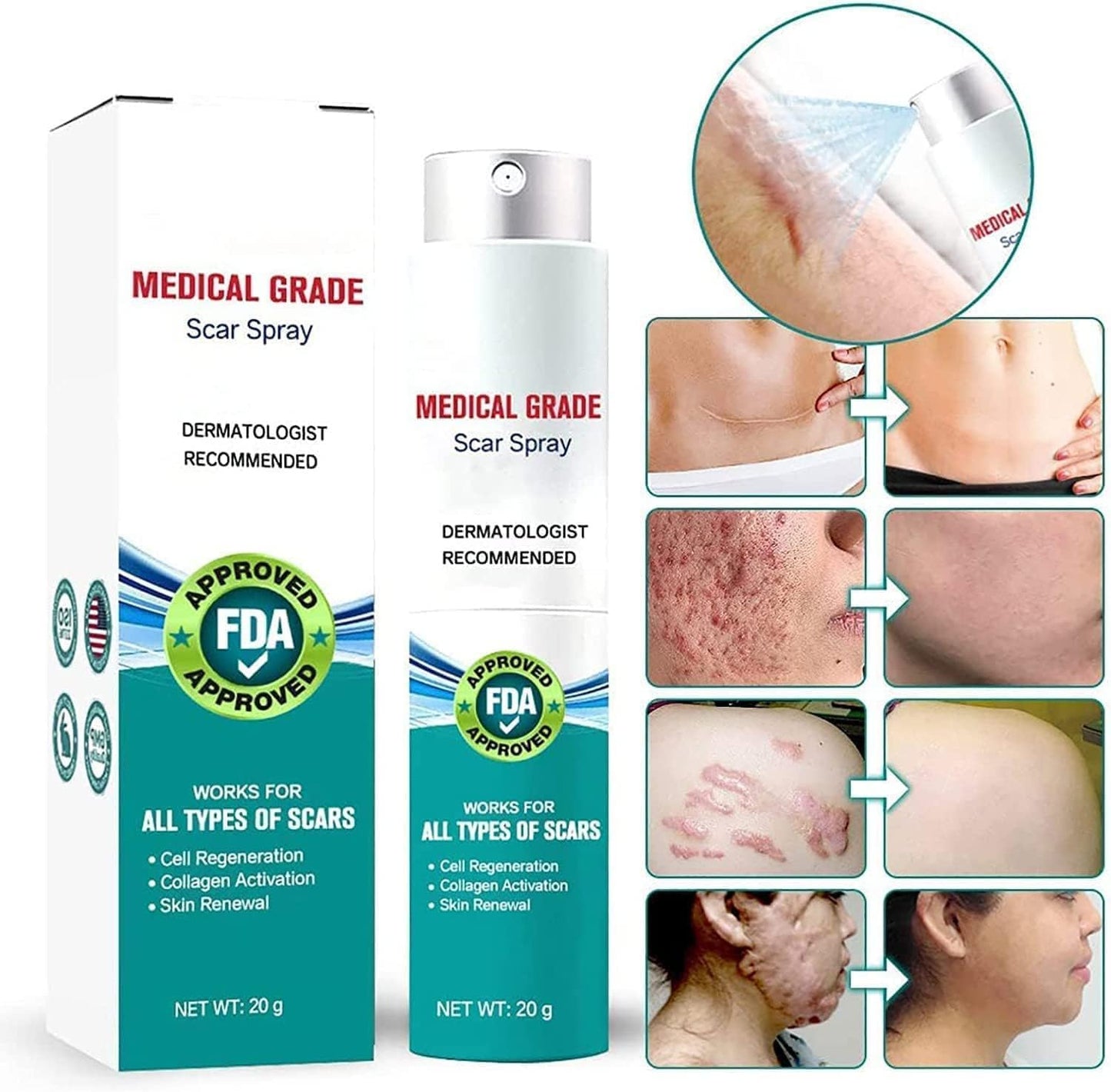 2x1  Spray  Elimina Cicatrices